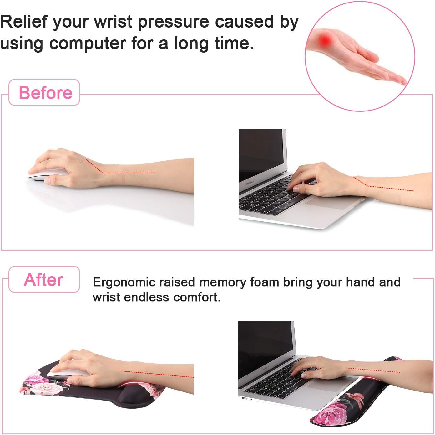 Ergonomic Peony Flower Keyboard & Mouse Wrist Rest Set - Memory Foam Support for Comfort & Pain Relief